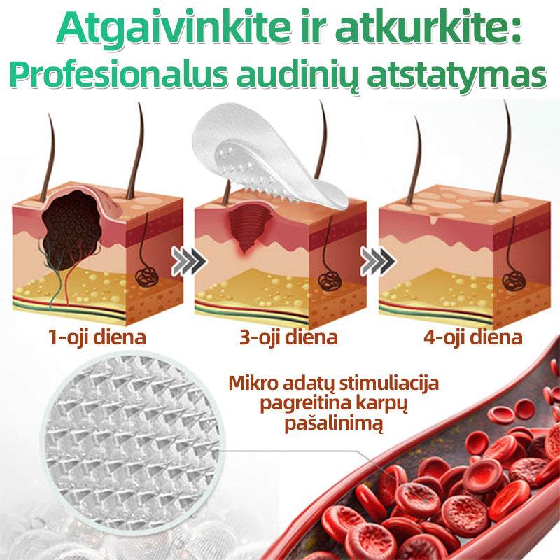 🍄2️⃣Hudros® 2 viename mikroadatų pleistras – tikslinga pagalba nuo karpų, odos darinių, spuogų ir tamsių dėmių