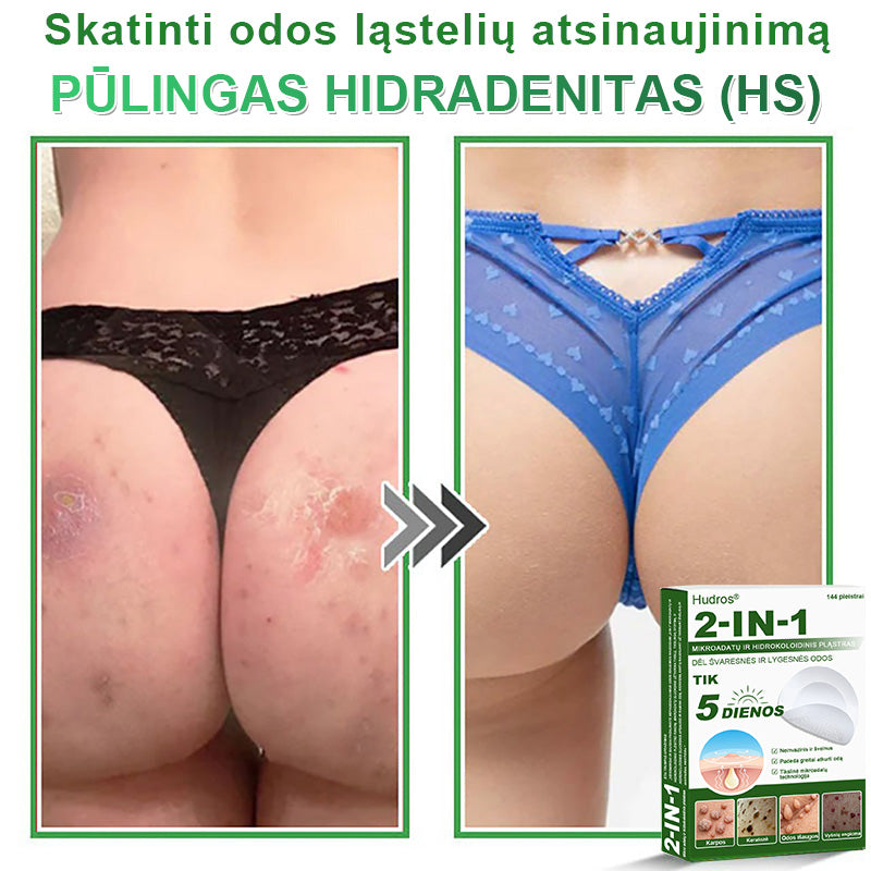 🍄2️⃣Hudros® 2 viename mikroadatų pleistras – tikslinga pagalba nuo karpų, odos darinių, spuogų ir tamsių dėmių