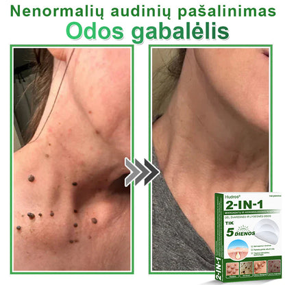 🍄2️⃣Hudros® 2 viename mikroadatų pleistras – tikslinga pagalba nuo karpų, odos darinių, spuogų ir tamsių dėmių