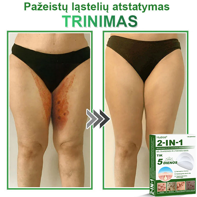 🍄2️⃣Hudros® 2 viename mikroadatų pleistras – tikslinga pagalba nuo karpų, odos darinių, spuogų ir tamsių dėmių