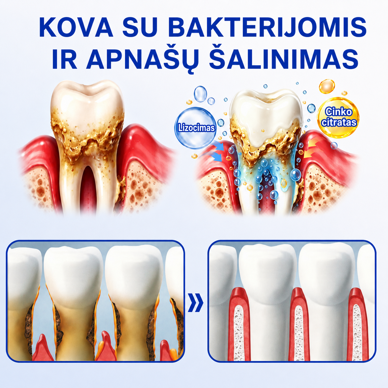 🇱🇹🦷2️⃣ Trilumia® GumRevive – pažangus gelis dantenų ir periodonto priežiūrai