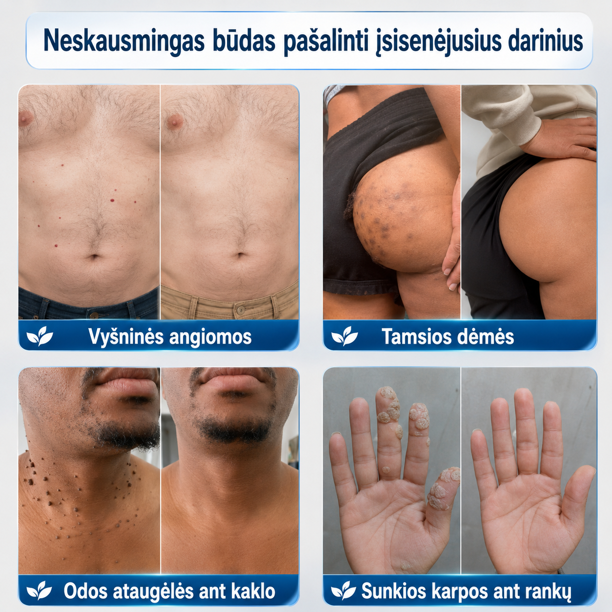 Trilumia® tikslinės odos priežiūros priemonės vaizdas 3